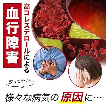 Amazon | 【第3類医薬品】コレストン 168カプセル | コレストン